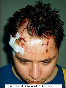gustav injured brawl n-am vazut subiectul pus forum.sper bine daca pun fost lene traduc )drummer
